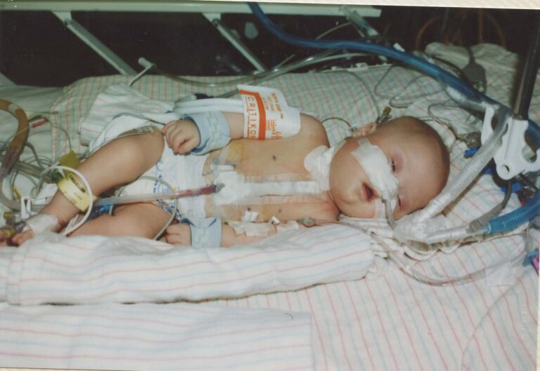 Baby Chritina heart surgery