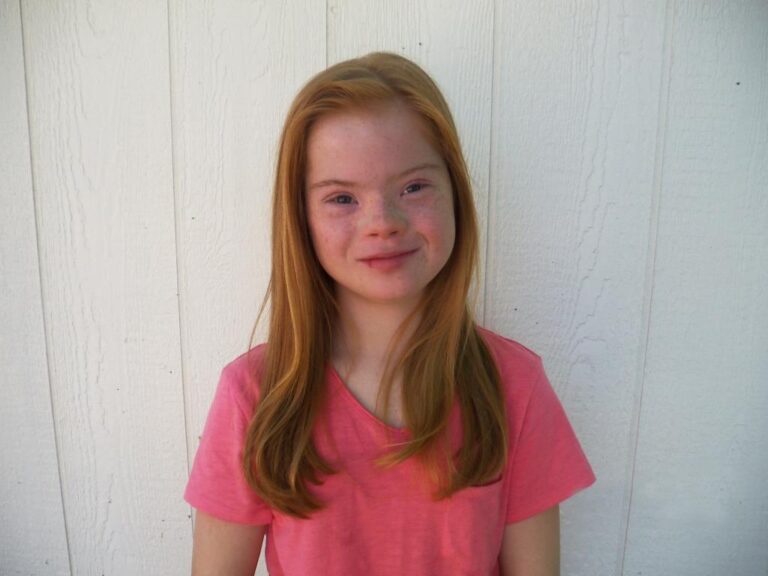 Girl with Down Syndrome