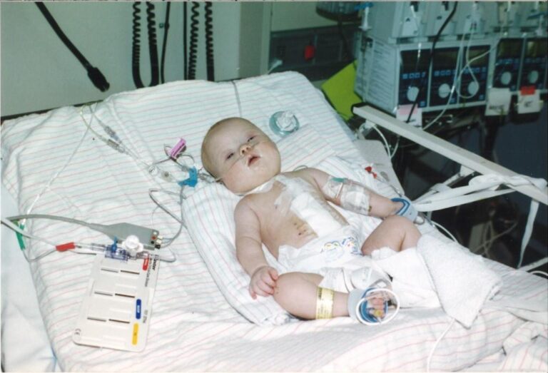 Baby girl with Down Syndrome after having open heart surgery